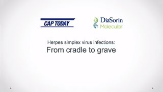 Herpes simplex virus infections from cradle to grave [upl. by Anilecram260]