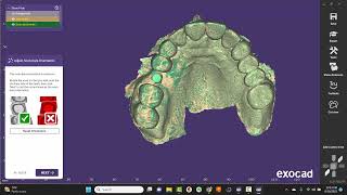 EXOCAD Single Implant Crown [upl. by Brass214]