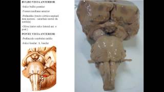 ANATOMIA MACROSCÓPICA DO SNC PARTE 1  TRONCO ENCEFÁLICO [upl. by Monro514]