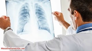 How Does Asbestos Cause Mesothelioma  Mesothelioma and Asbestos Exposure [upl. by Garretson]