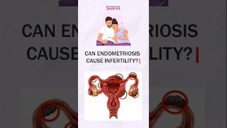 Can Endometriosis Cause Infertility   Dr Debasish Sarkar drdebashishsarkar endometriosis sarkar [upl. by Aninep279]