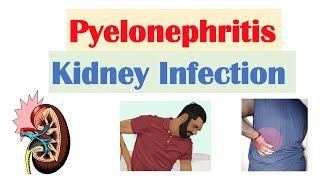 Pyelonephritis Kidney Infection  Causes Pathophysiology Signs amp Symptoms Diagnosis Treatment [upl. by Burty]