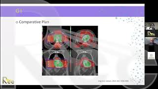 IMRT 20  Session 15  High yield clinical applications of IMRT Part 2 [upl. by Eelrebmyk]