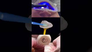 Why Dental Ceramic is the Future of Dentistry [upl. by Linkoski]