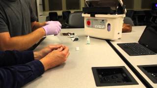 How to Run a Malaria Rapid Diagnostic Test [upl. by Kenwood718]