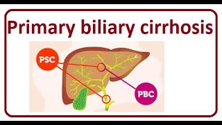 Primary Biliary Cirrhosis  2024 [upl. by Grissel349]