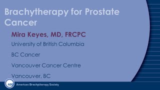 Brachytherapy for Prostate Cancer [upl. by Aidyn]