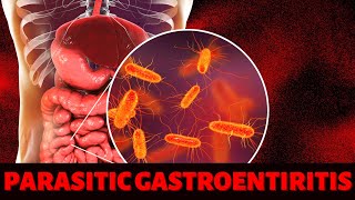 PARASITIC GASTROENTIRITIS [upl. by Novia]