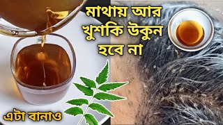 চুলের খুশকি নিকি উকুন দূর করার সবচেয়ে সহজ উপায়  মাথায় কখনো হবেনা  Get Rid of Lice amp Nits Dandruff [upl. by Wulf]