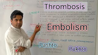 Thrombosis and Embolism  Biology class 11  Dr Mushtaq Pashto Lectures [upl. by Amena375]