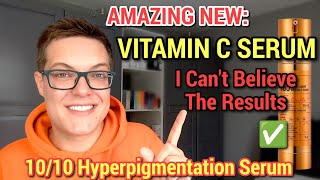 ULTIMATE HYPERPIGMENTATION SERUM  Next Level Korean Skincare Vitamin C [upl. by Nnahtebazile]