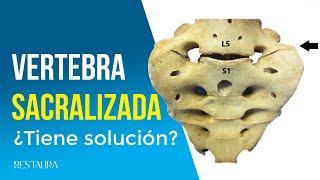 Vertebra sacralizada ¿Tiene solución [upl. by Ballman436]