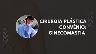 CIRURGIA PLÁSTICA PELO CONVÊNIO GINECOMASTIA [upl. by Enedan]