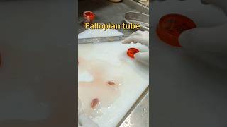 Fallopian tube biopsy sample tissuefixation tissuepreparation biopsy pathology [upl. by Plunkett]