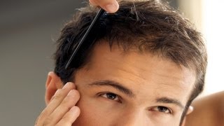 How to Treat Balding Hair  Thinning Hair [upl. by Betsey814]