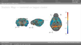 Data Analysis in fMRI  Experimental Neuroimaging Course 2018  Zurich CH [upl. by Heiney767]