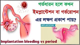 Implantation symptoms Implantation bleeding vs period  how to know the difference [upl. by Chem170]