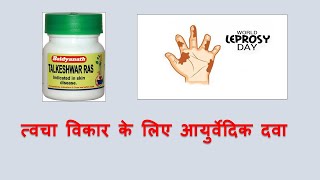 Talkeshwar ras l Leprosy l ayurvedictreatment ayurveda ayurvedicmedicines [upl. by Nivac277]