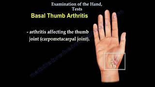 Examination Of The Hand Tests for examination of the hand carpal tunnel syndrome [upl. by Adnalay]