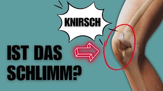 Knirschen im Knie Solltest du dir Sorgen machen [upl. by Maddy]