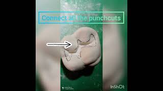 Class1 cavity preparation on plaster model  Preclinical conservative dentistry and endodontics 2yr [upl. by Rolfston]