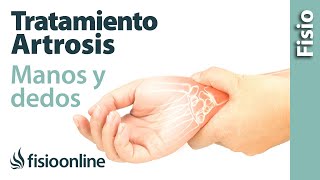 Tratamiento de fisioterapia para la artrosis de manos y dedos [upl. by Enilrad177]