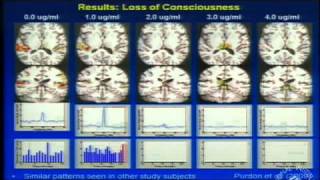 A Look at the Unconscious Brain Under General Anesthesia [upl. by Aibun]