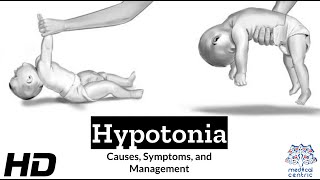 Hypotonia Explained What You Need to Know [upl. by Junette591]