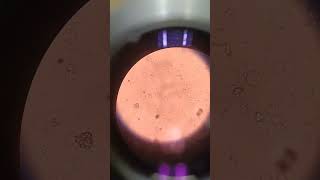 Urine Microscopy  Hematology Lab laboratory hospital machine work [upl. by Weight]