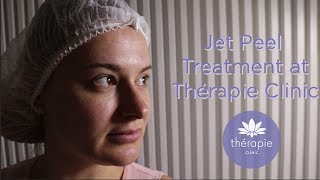 Jet Peel Treatment  Thérapie Clinic [upl. by Maffei99]