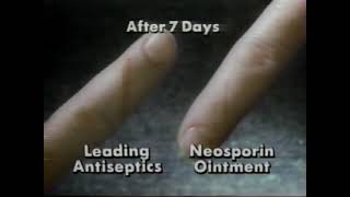 Neosporin Commercial 1991 [upl. by Everard]