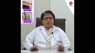 In Homoeopathy Psoriasis can be Treatable  Dr Renu Paul [upl. by Nnednarb]