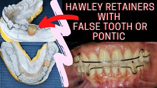 Hawley RETAINERS with FALSE TOOTH or Pontic  PHILIPPINES [upl. by Roderica359]