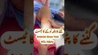 acl orthopedics sportsmedicine sportsinury orthocenter orthocare arthroscopicsurgery ortho [upl. by Unders897]