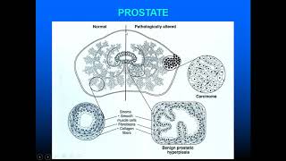 Pathology of the Male Reproductive System spermatic cords accessory glands penis and prepuce [upl. by Tia]