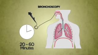 Bronchoscopy [upl. by Adams20]