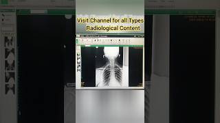 Master Tutorial Fujifilm FCR System xray radiology ct trending viralshorts shorts doctorneet [upl. by Arykat]