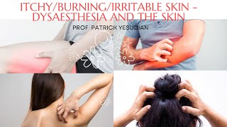 IrritableItchyBurning skin  Dysaesthesia and the skin [upl. by Esyak]