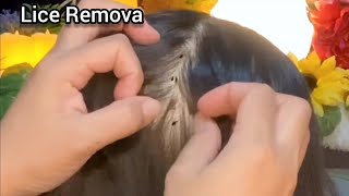 ASMR You have bad lice problem Sis will help to remove it  No Talking 😴💤🥱 [upl. by Erastatus]