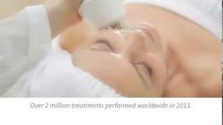 Pollogen Face Treatment [upl. by Akenat]