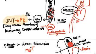 Hematology  AntiCoagulants [upl. by Janith]