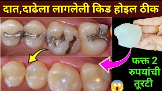 घरातील फक्त 2 वस्तू वापरा दातांन संबंधित सर्व समस्या दूर होतील😱 kitchen tips  home remedies  teeth [upl. by Etteragram603]