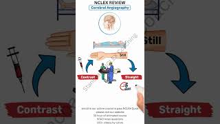 nclex review cerebral angiography nclexreview [upl. by Ardnauq]