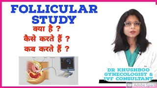 Follicular Study क्या होती है Hindi  Dr Khushboo  Mannat IVF Patna [upl. by Anauj]