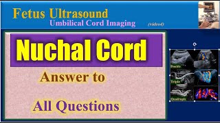 Fetus Ultrasound Nuchal Cord Answer to All Questions [upl. by Leima]