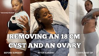 Finding out I HAD ENDOMETRIOSIS AND AN 18CM CYST in my Ovary Right ovary gets removed [upl. by Anahcra620]