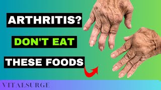 9 Foods To Avoid for Arthritis Stop Now [upl. by Acnaiv]