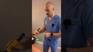 Shockwave Therapy for Frozen Shoulder Shoulder Impingement and Labral Degeneration [upl. by Aydin]