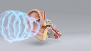 Explore the Science of Hearing Loss  MiracleEar Hearing Center [upl. by Mariska]