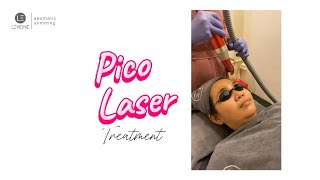 Pico Laser Treatment [upl. by Aggri]